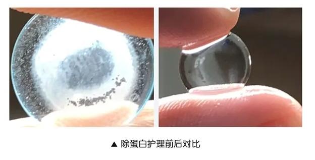 角膜眼鏡